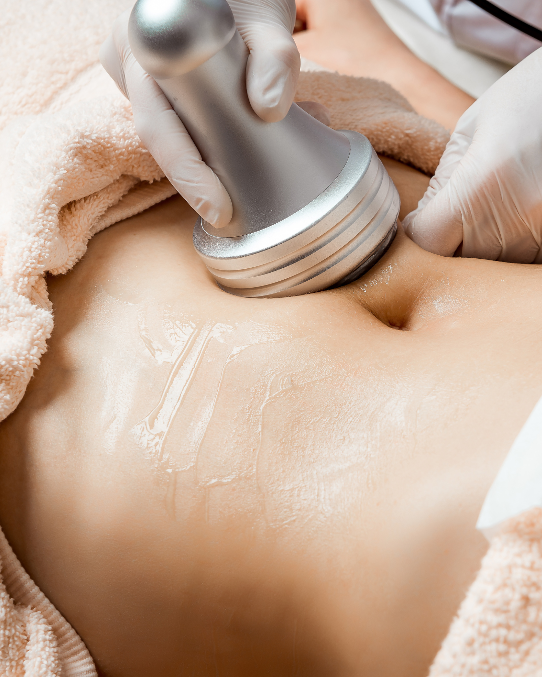 Painless Tummy Tuck - 3 Sessions